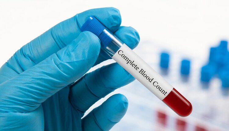Blood Testing Services